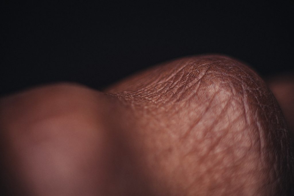close up photo of human skin
